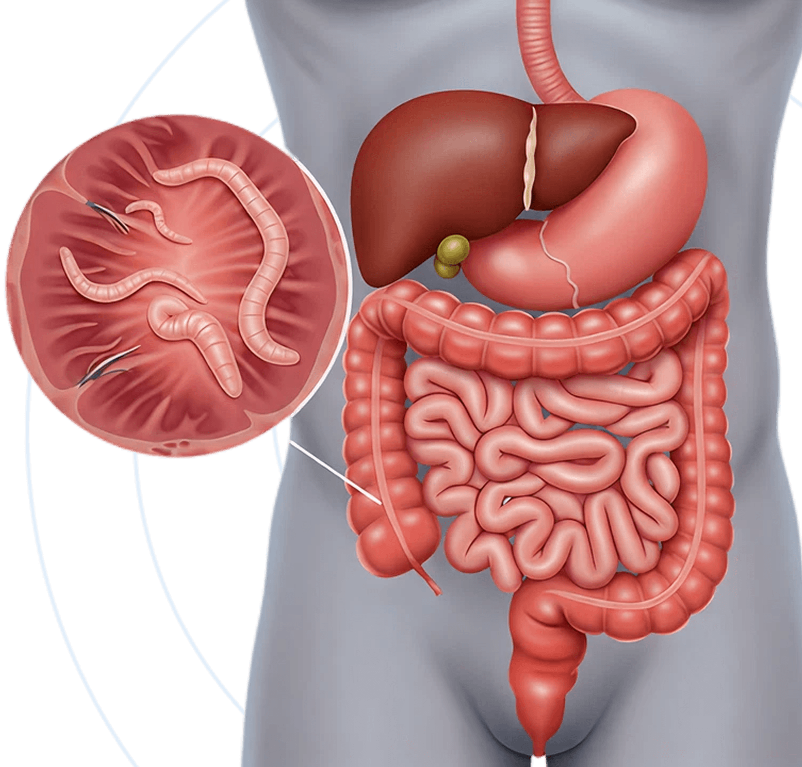 Anthelmintic & Anti-worm