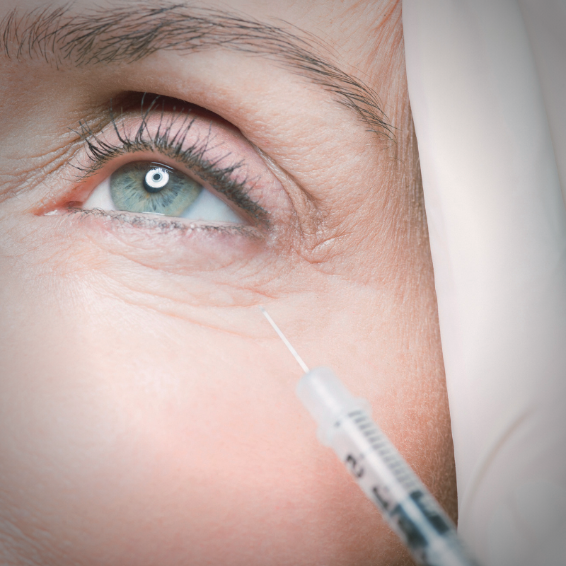 Eye Injections Eye Injections