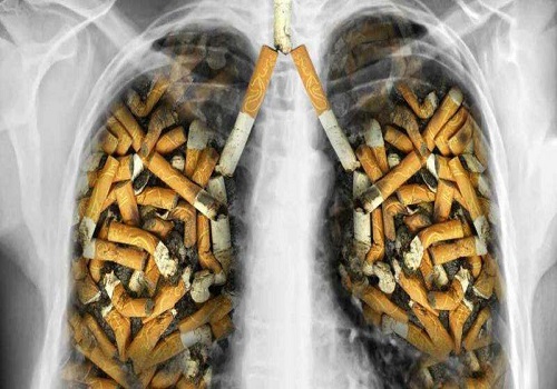 Lung Cancer: Hard Battle to fight alone