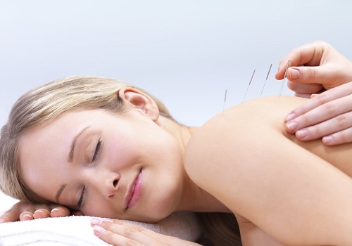 Combat Symptoms of Menopause with Needle Therapy