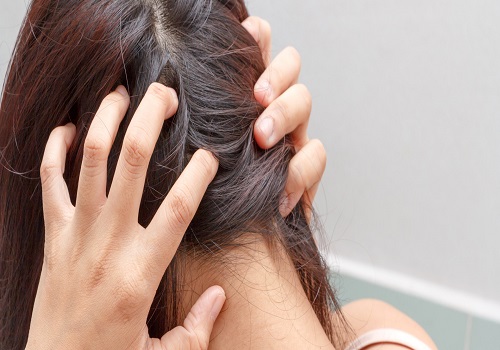 Disorders That Are Associated With The Scalp