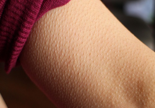 Get To Know About The Science Behind Goosebumps